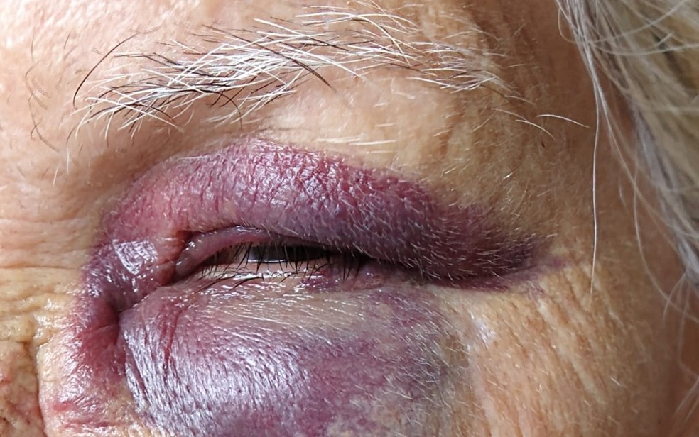 Filho é preso suspeito de agredir a mãe de 78 anos